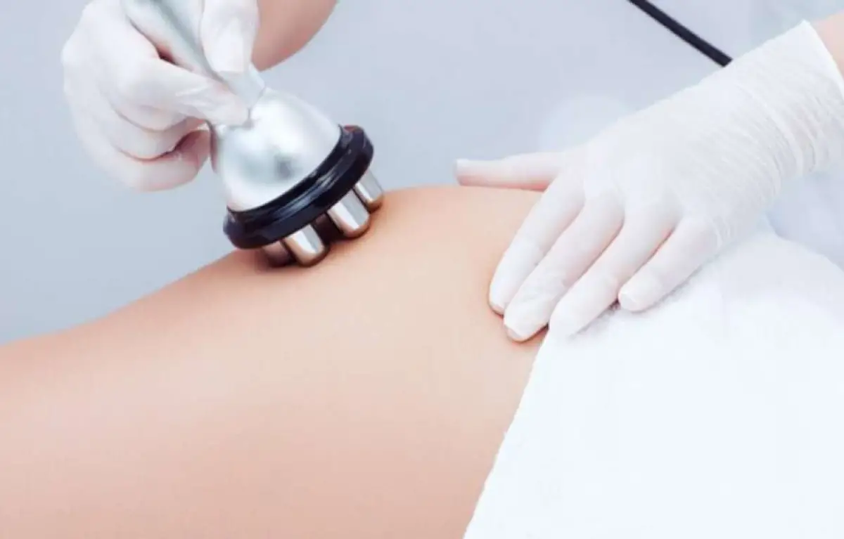 Cellulite Therapy – Lymphatic 8+2 sessions